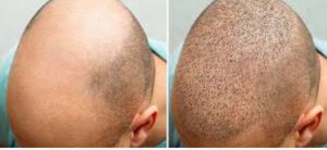 Screenshot_20250801_121101_Gallery