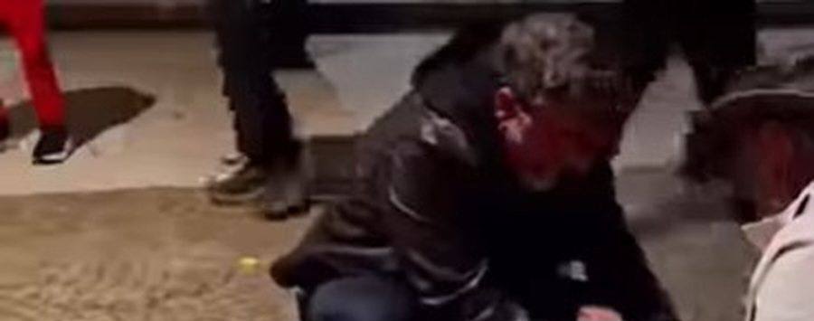 TRAZIRAT e ndeshjes/ Deputeti njohur ben gjestin e madh, i vjen në ndihmë tifozes që kishte humbur ndjenjat